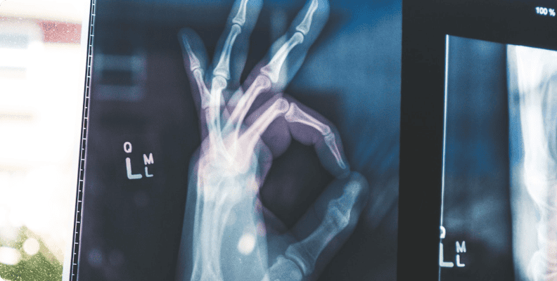 Rectangle 229 3 Ossio – Naturally Transformative Bone Healing