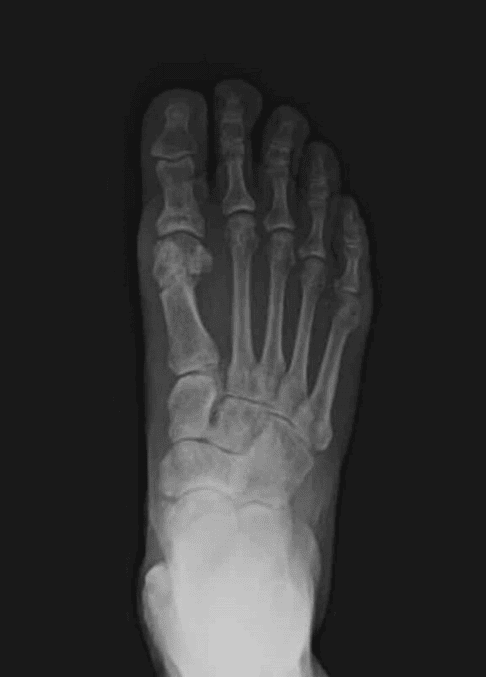 New Project 1 1 Ossio – Naturally Transformative Bone Healing