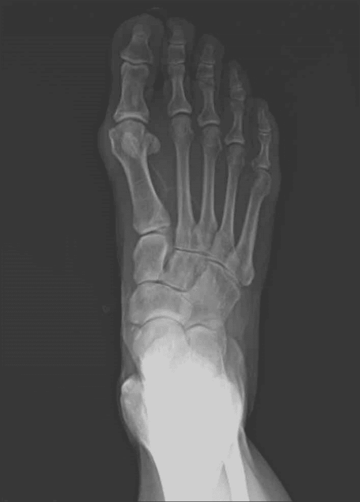 Image 1 1 Ossio – Naturally Transformative Bone Healing