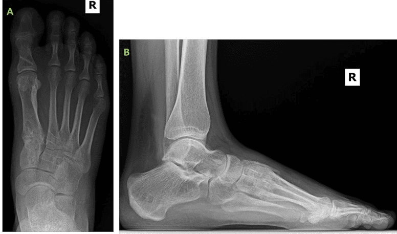 Foot & Ankle Anatomy - Golden State Orthopedics & Spine