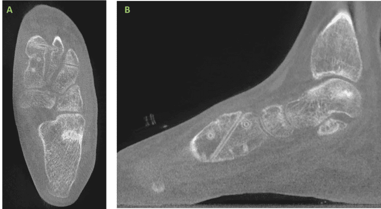 5 Ossio – Naturally Transformative Bone Healing