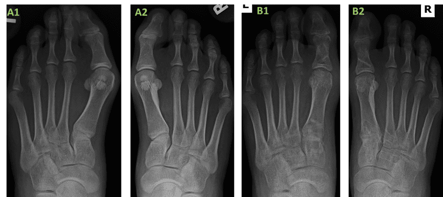 6 Ossio – Naturally Transformative Bone Healing