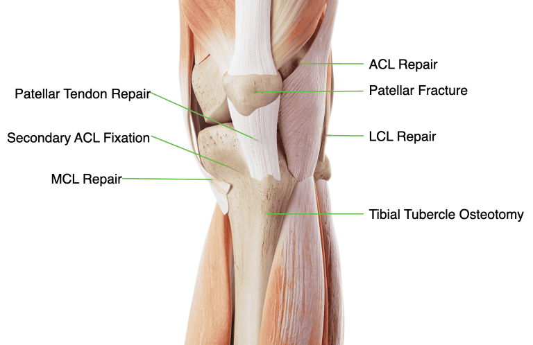 Mobile Sports Knee Updated Ossio – Naturally Transformative Bone Healing