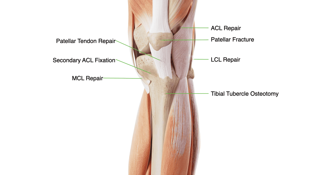 Sport Knee Updated Ossio – Naturally Transformative Bone Healing