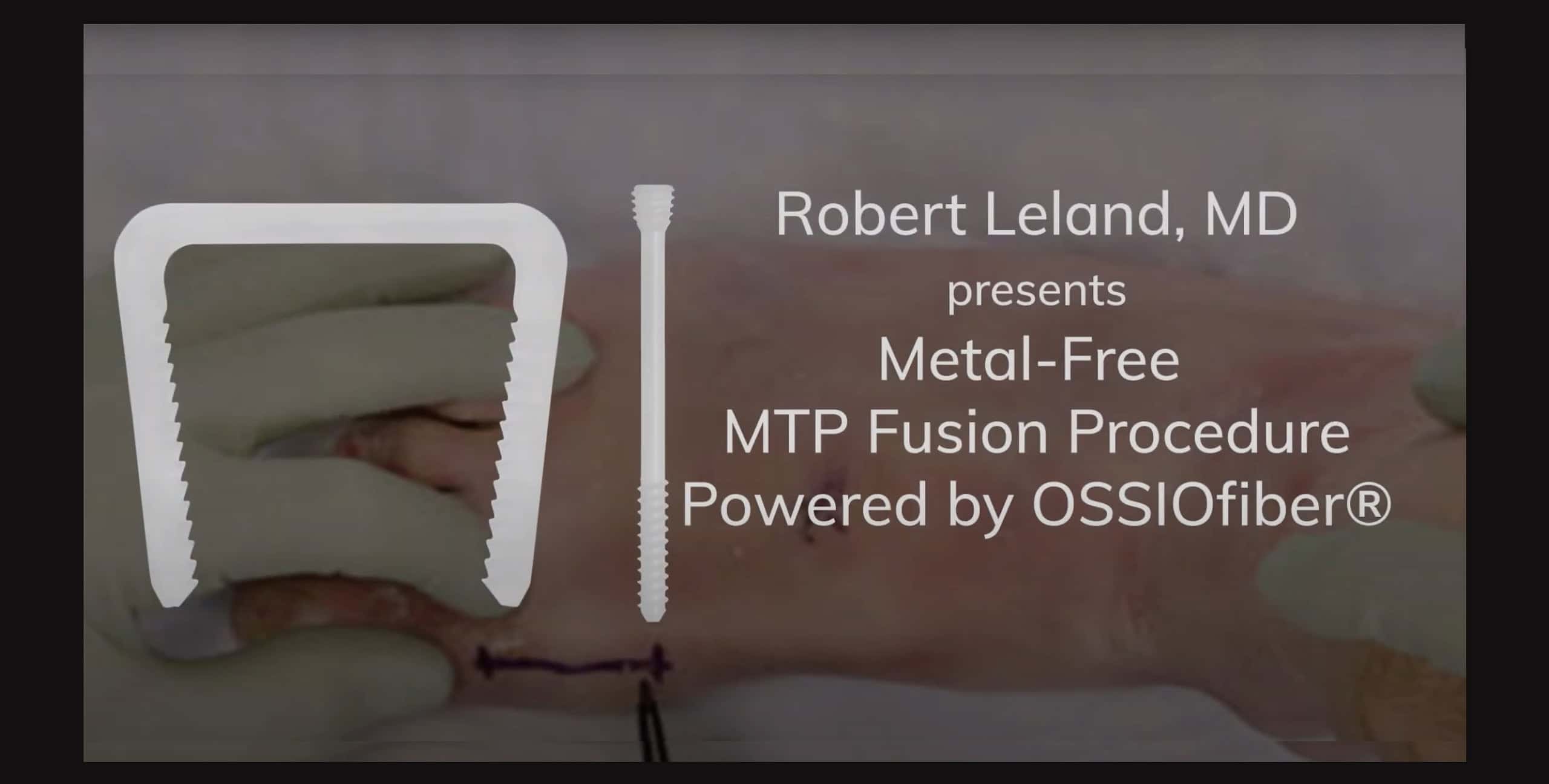 Robert Leland Thumbnail 2 Scaled Ossio – Naturally Transformative Bone Healing