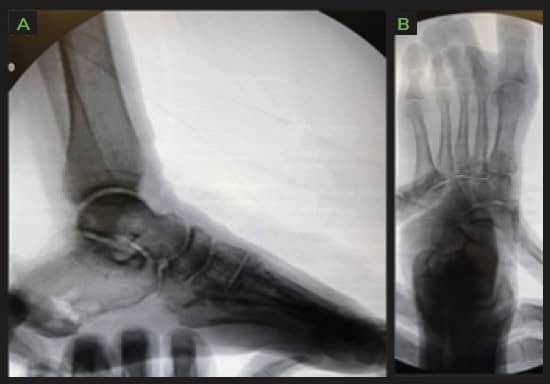 Screenshot 2024 09 05 At 19.06.47 Ossio – Naturally Transformative Bone Healing