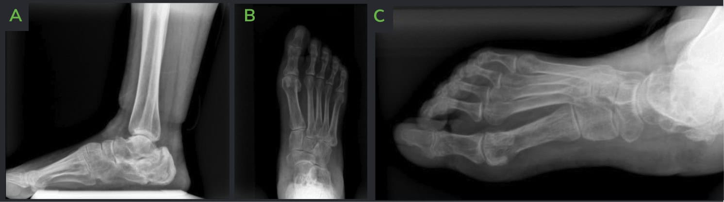 Screenshot 2025 01 31 At 19.35.20 Ossio – Naturally Transformative Bone Healing