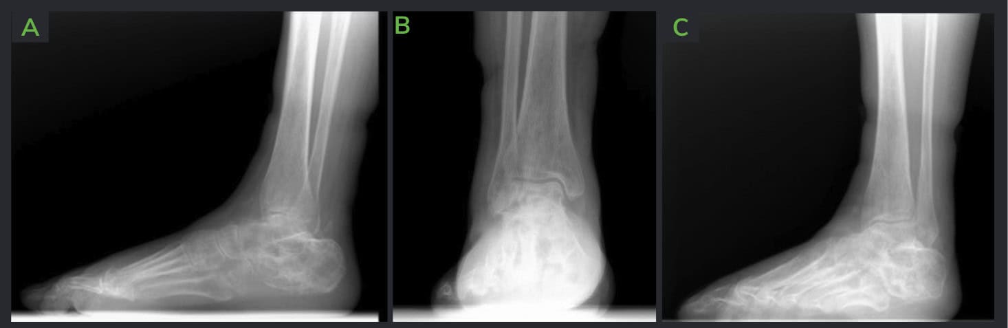 Screenshot 2025 01 31 At 19.45.01 Ossio – Naturally Transformative Bone Healing