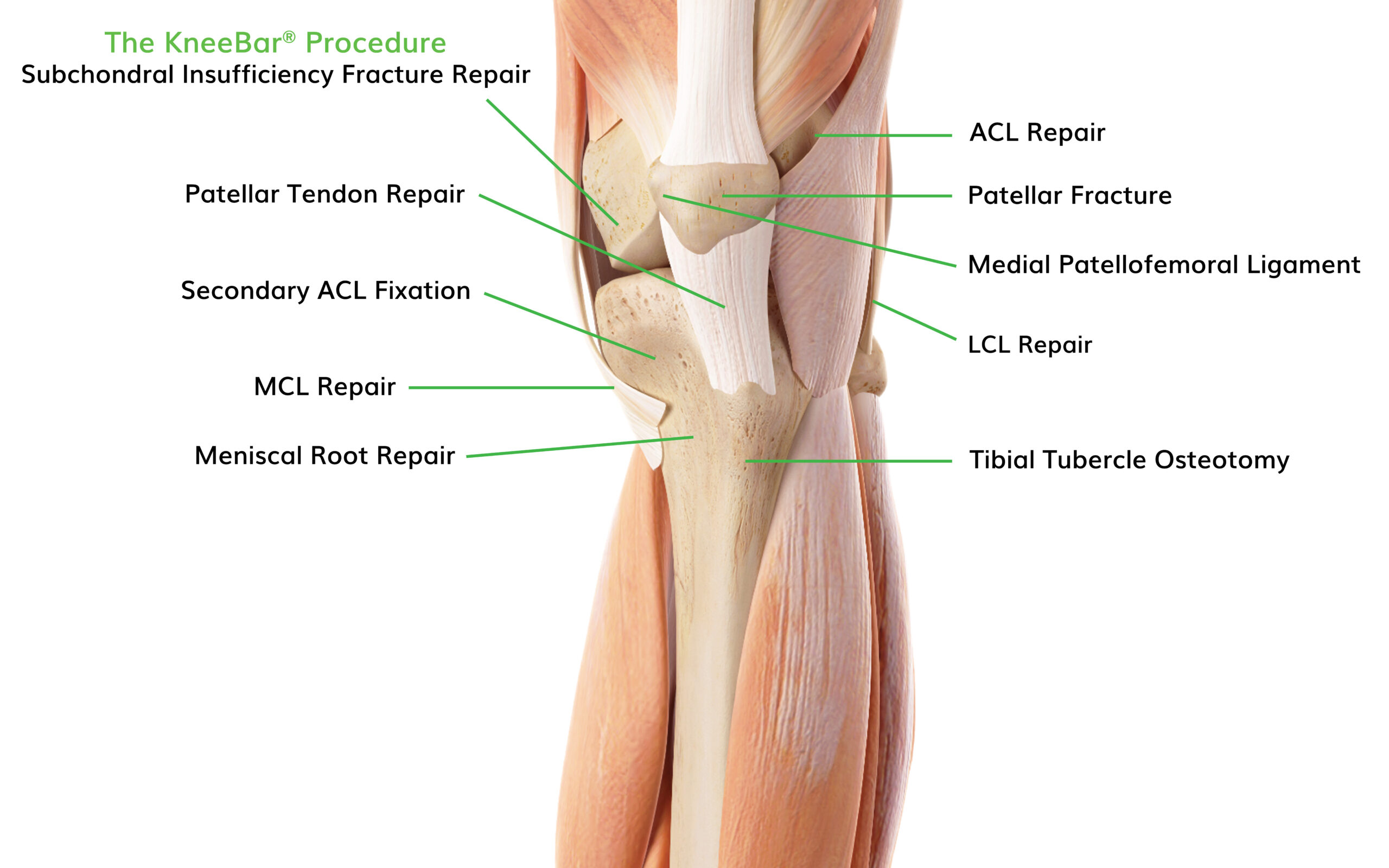 Web Knee Scaled Ossio – Naturally Transformative Bone Healing