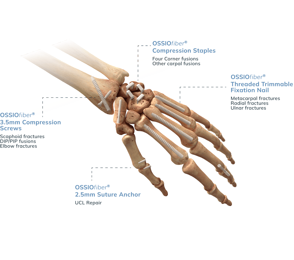 6 Hand Wrist Details Ossio – Naturally Transformative Bone Healing