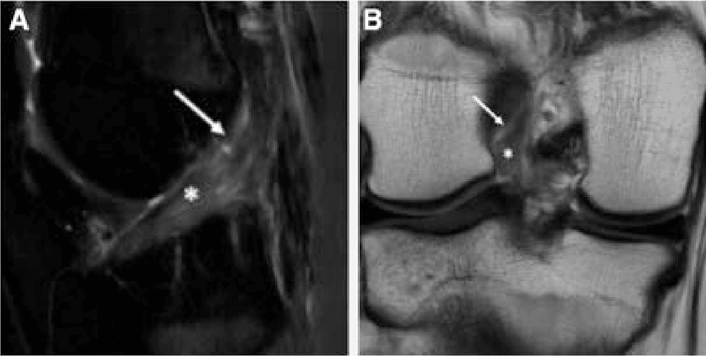Sagittal-Plane T2-Weighted Mri