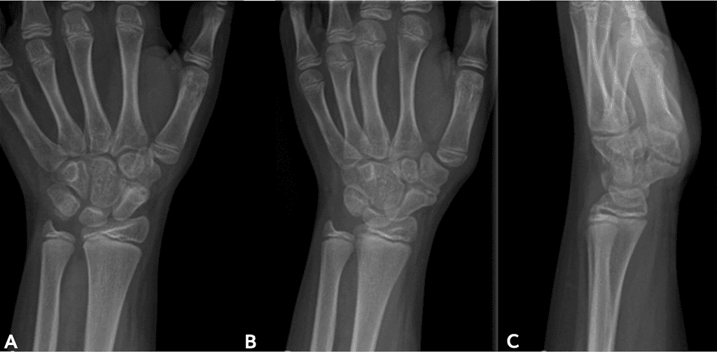 Screenshot 2026 01 20 At 2.47.37 Pm Ossio – Naturally Transformative Bone Healing