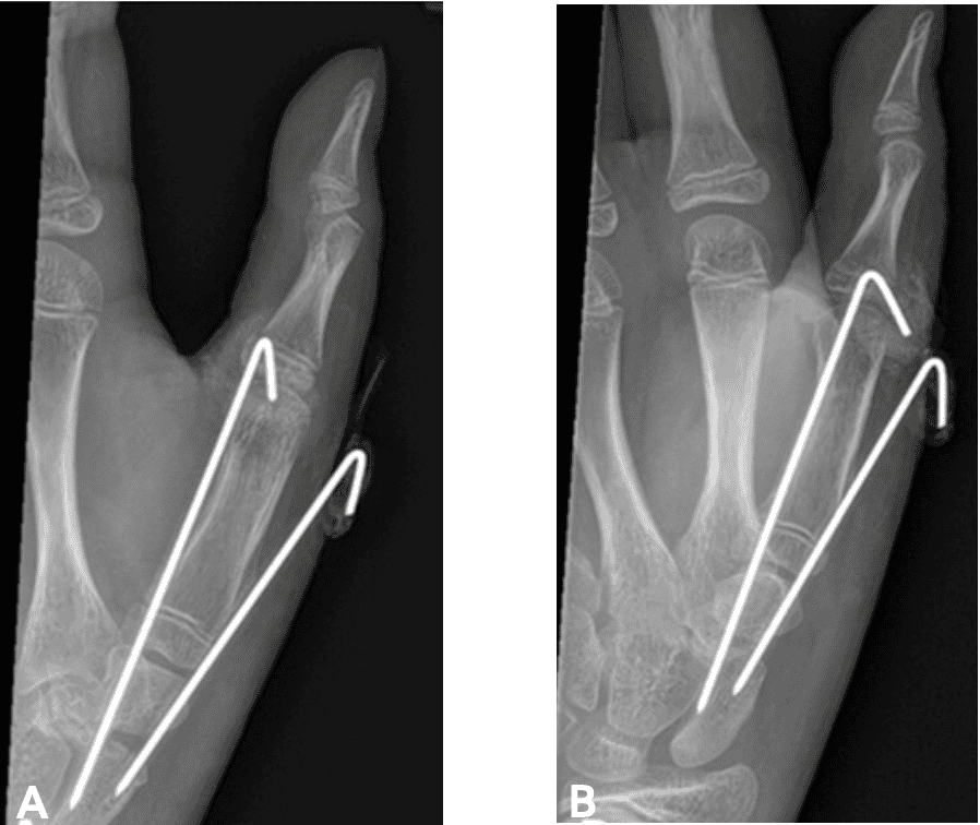 Screenshot 2026 01 20 At 2.48.03 Pm Ossio – Naturally Transformative Bone Healing