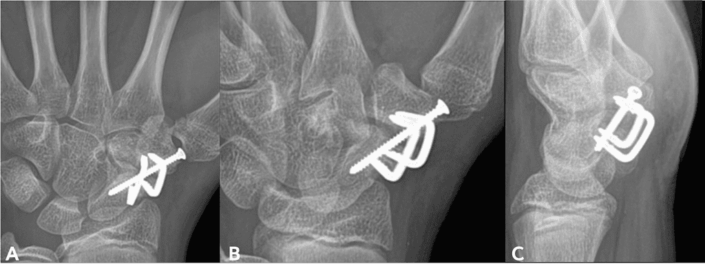 Screenshot 2026 01 20 At 2.48.25 Pm Ossio – Naturally Transformative Bone Healing