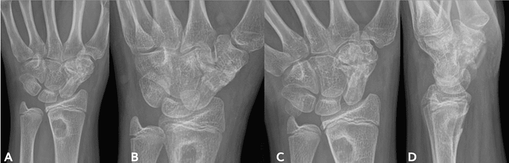 Screenshot 2026 01 20 At 2.48.43 Pm Ossio – Naturally Transformative Bone Healing