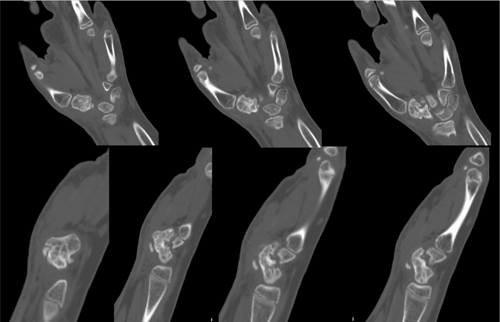 Screenshot 2026 01 20 At 2.49.07 Pm Ossio – Naturally Transformative Bone Healing