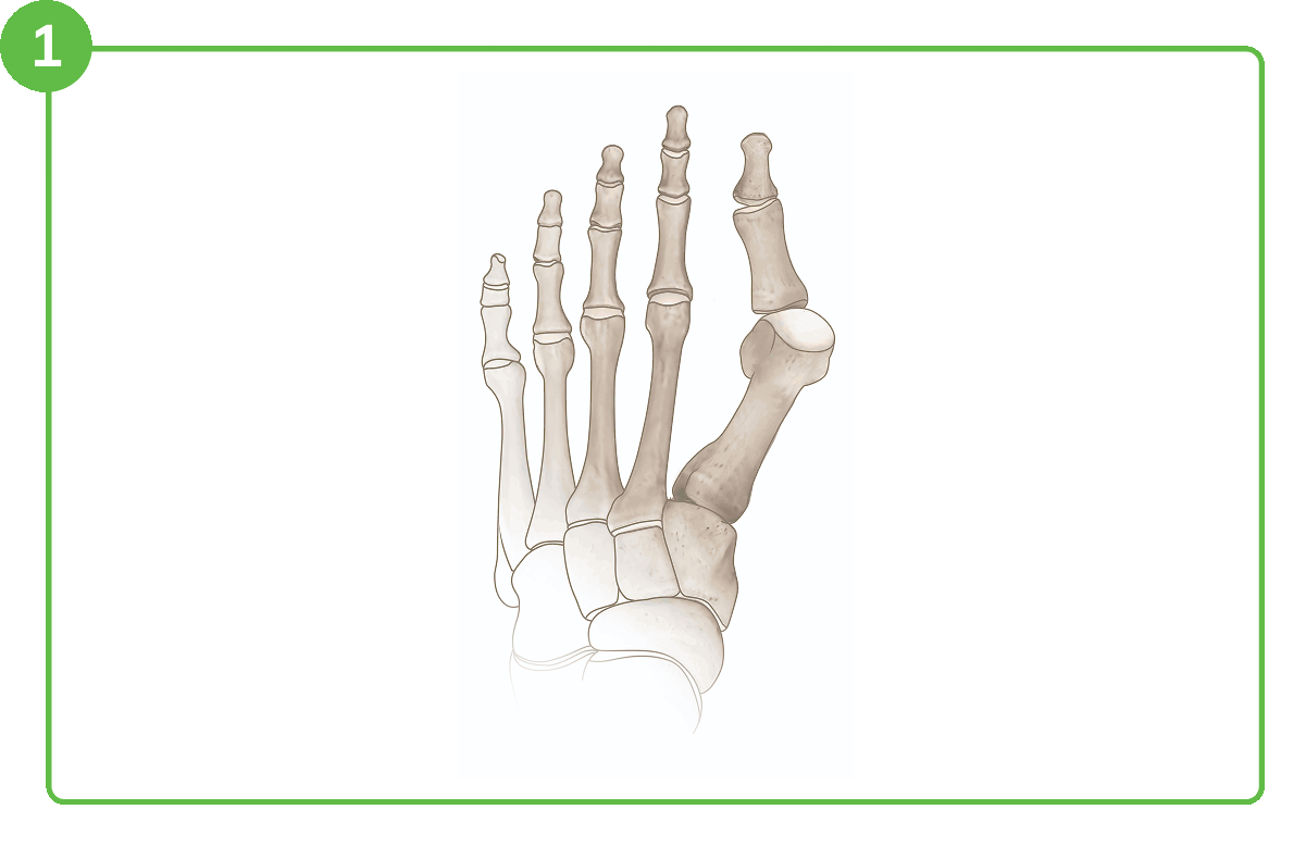 Mia Gif Ossio – Naturally Transformative Bone Healing