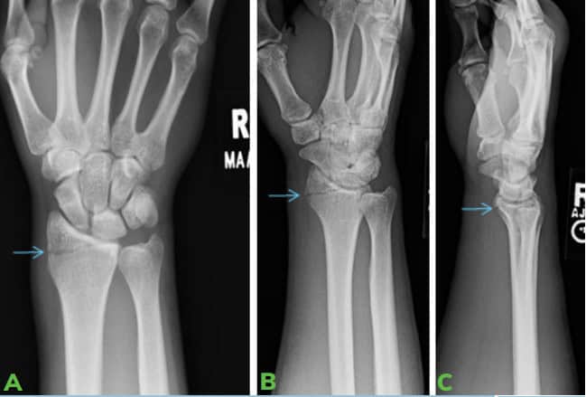 2 Image Ossio – Naturally Transformative Bone Healing