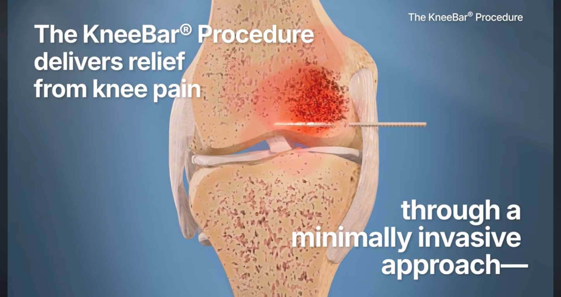 Image 18 Ossio – Naturally Transformative Bone Healing